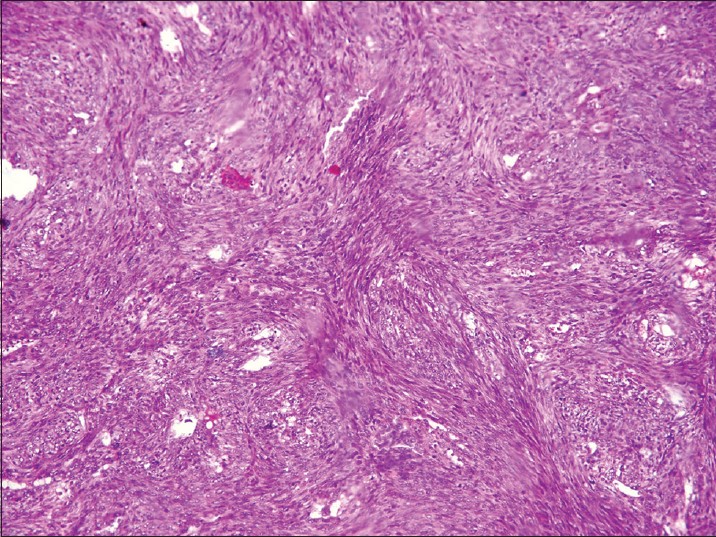 Саркома Молочной Железы Фото – Telegraph