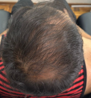 Caso 40 hombre después