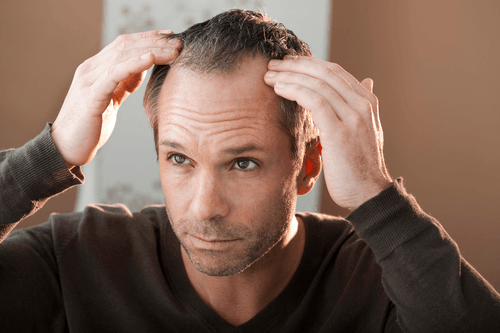 Hair Loss Panel-4
