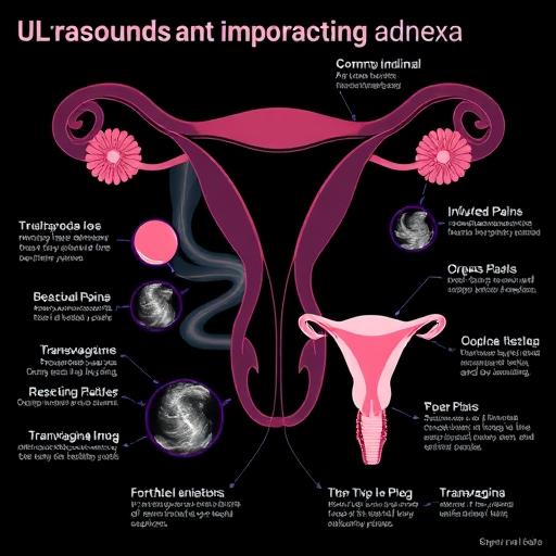 УЗИ придатков и матки: важный диагностический инструмент