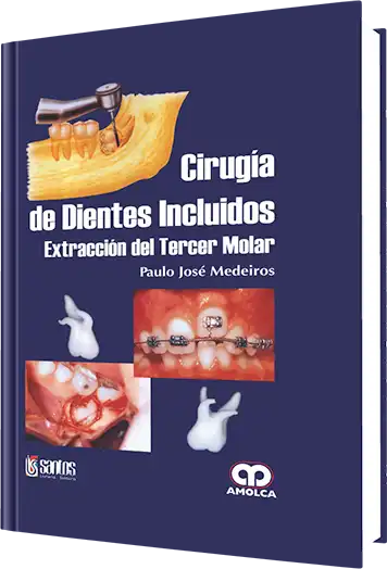 Cover for Cirugía de Dientes Incluidos Extracción del Tercer Molar