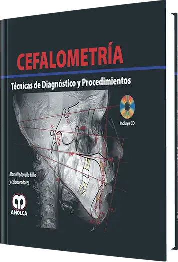 Cover for Cefalometría. Técnicas de Diagnóstico y Procedimientos