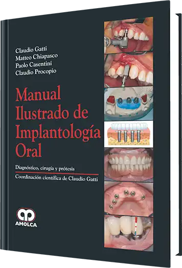 Cover for Manual Ilustrado de Implantología Oral
