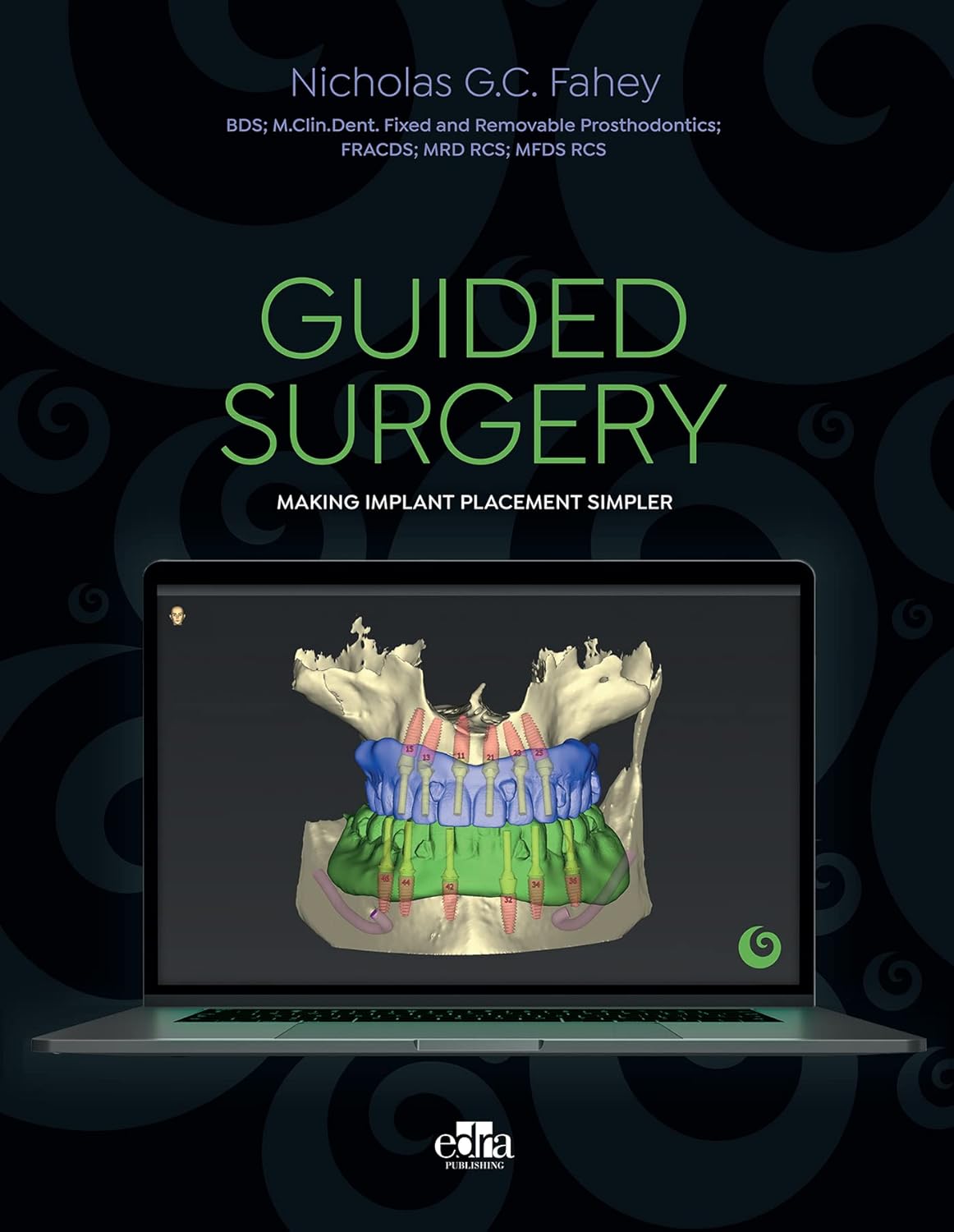 Cover for GUIDED SURGERY: Making implant placement simpler