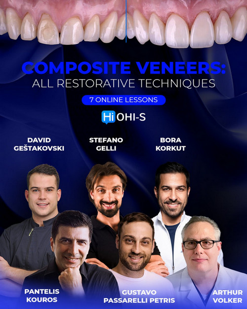 Cover for Composite Veneers: All Restorative Techniques