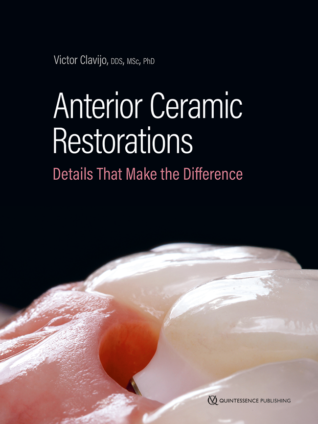 Cover for Anterior Ceramic Restorations Details That Make the Difference