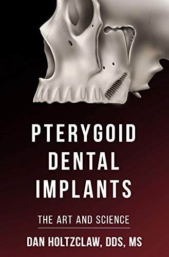 Pterygoid Dental Implants