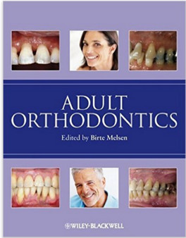 Cover of Adult Orthodontics 1st Edition
