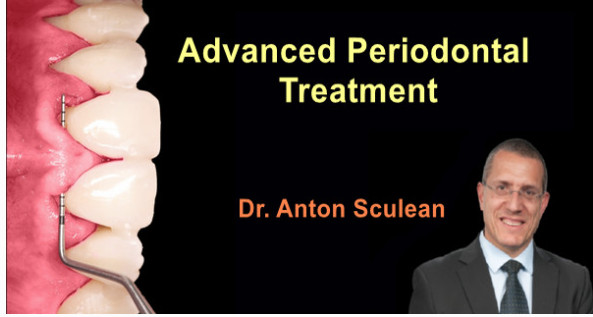 Cover of Advanced Periodontal Treatment (Video Course)