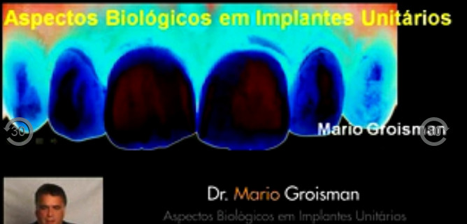 Cover of Aspectos Biologicos em Implantes Unitarios