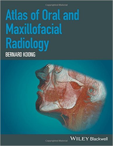 Cover of Atlas of Oral and Maxillofacial Radiology 1st Edition PDF