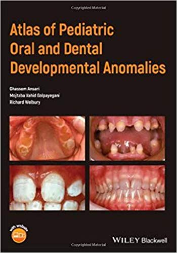 Cover of Atlas of Pediatric Oral and Dental Developmental Anomalies 1st Edition PDF