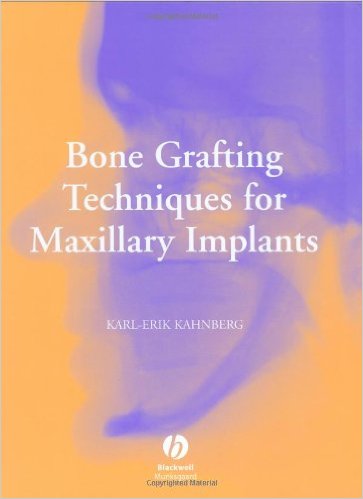 Cover of Bone Grafting Techniques for Maxillary Implants 1st Edition