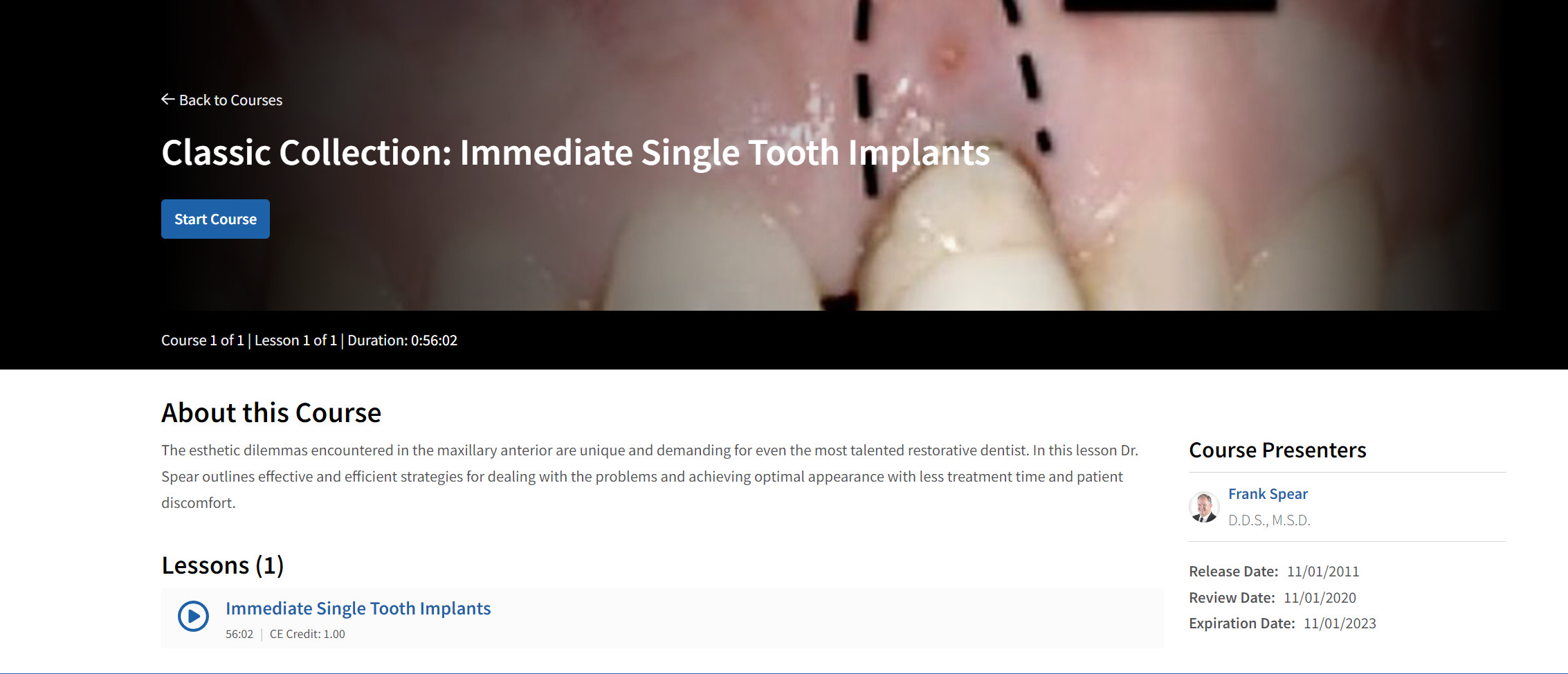 Cover of Classic Collection: Immediate Single Tooth Implants