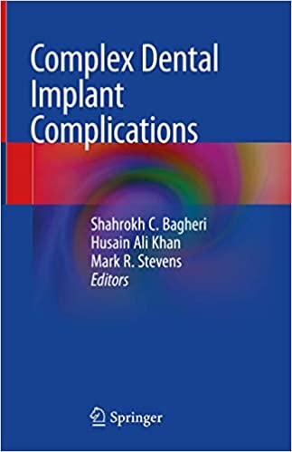 Cover of Complex Dental Implant Complications 1st ed. 2020 Edition PDF
