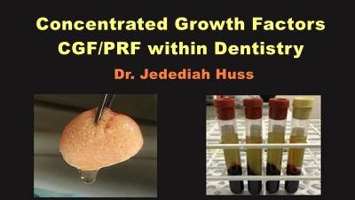 Concentrated Growth Factors: CGF/PRF within Dentistry (Video)