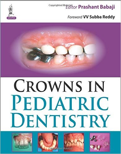 Cover of Crowns in Pediatric Dentistry 1st Edition