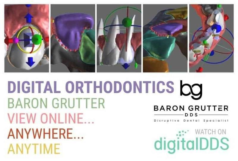 Cover of Digital Orthodontics Online Course (Clear Aligners) – Baron Grutter