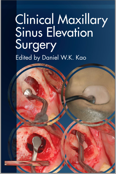 Cover of Ebook Clinical Maxillary Sinus Elevation Surgery 1st Edition