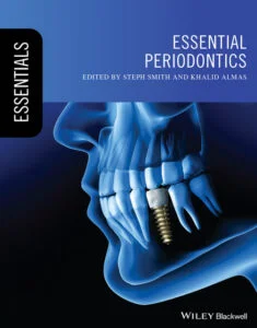 Cover of Essential Periodontics