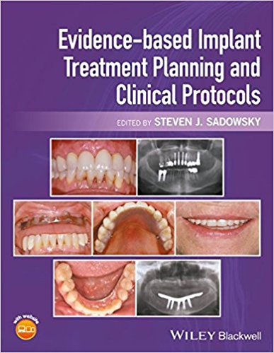 Cover of Evidence-Based Implant Treatment Planning and Clinical Protocols