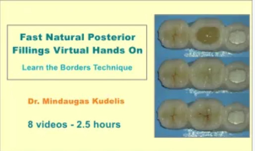 Cover of Fast Natural Posterior Fillings Virtual Hands On