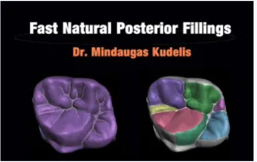 Cover of Fast Natural Posterior Fillings