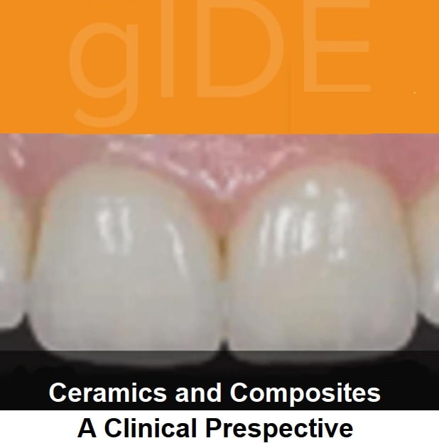Cover of gIDE online lectures – Ceramic and Composits, A Clinical Perspective