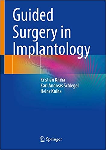 Guided Surgery in Implantology 1st ed. 2021 Edition PDF
