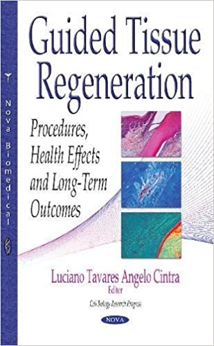 Cover of Guided Tissue Regeneration: Procedures, Health Effects and Long-term Outcomes PDF