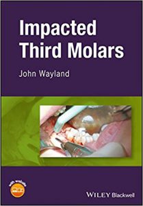 Cover of Impacted Third Molars PDF