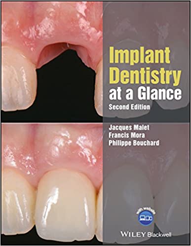 Cover of Implant Dentistry at a Glance 2nd Edition PDF