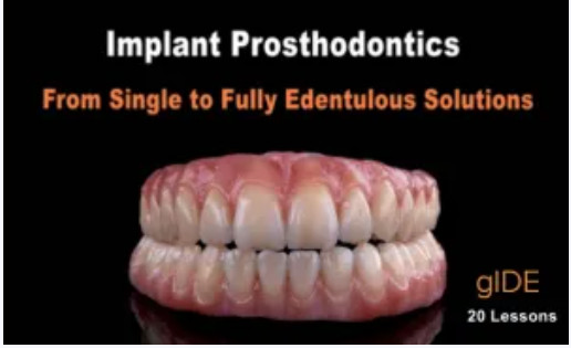Cover of Implant Prosthodontics – From Single to Fully Edentulous Solutions