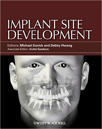 Implant Site Development 1st Edition