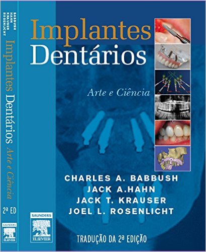 Implantes Dentários. Arte e Ciência (Em Portuguese do Brasil) cover