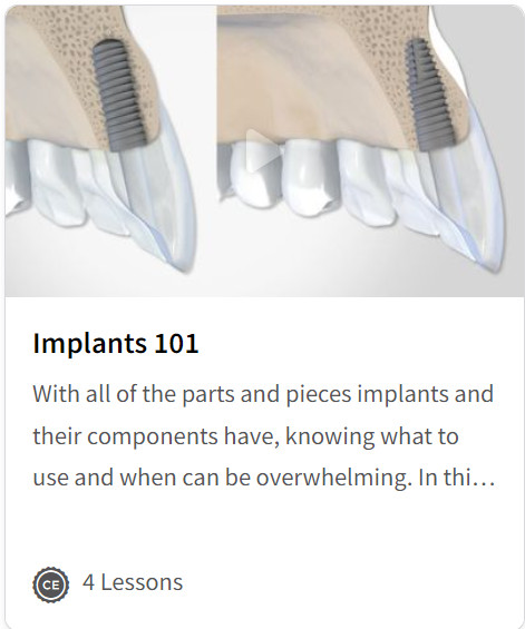Cover of Implants 101