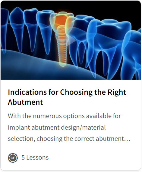 Cover of Indications for Choosing the Right Abutment