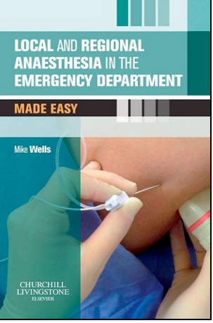 Local and Regional Anaesthesia in the Emergency Department Made Easy