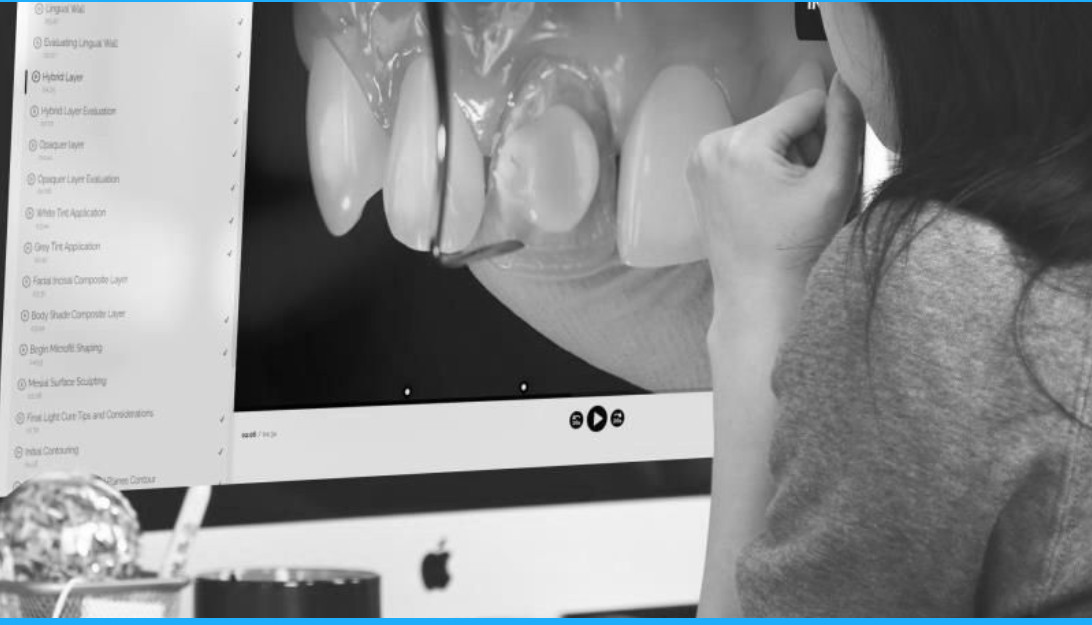 Masking the Dark Tooth with Direct Resin