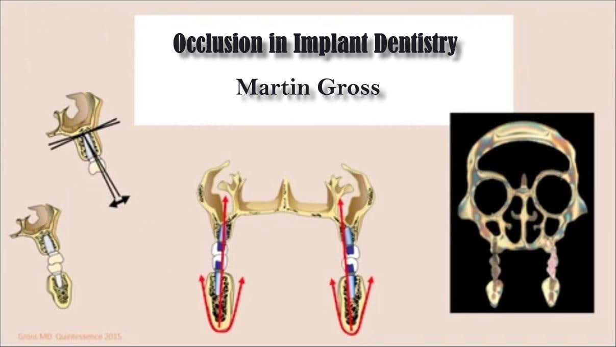 Cover of Occlusion in Implant Dentistry – Martin Gross