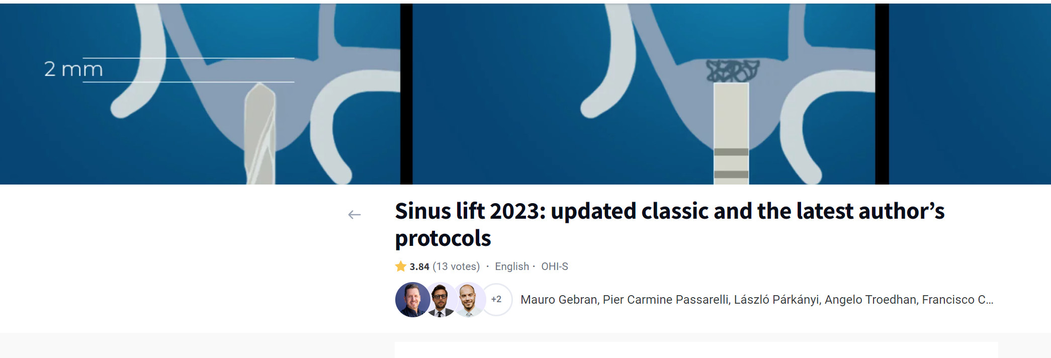 Cover of OHI-S Sinus Lift 2023: Updated Classic and the Latest Author’s Protocols