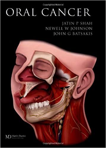 Cover of Oral Cancer ​PDF
