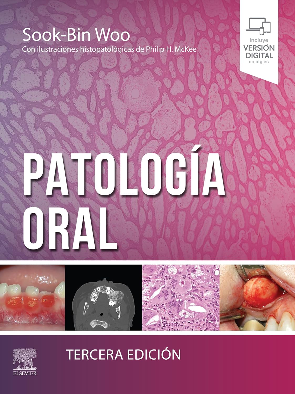 Patología oral, 3rd Edition (Original PDF from Publisher) cover