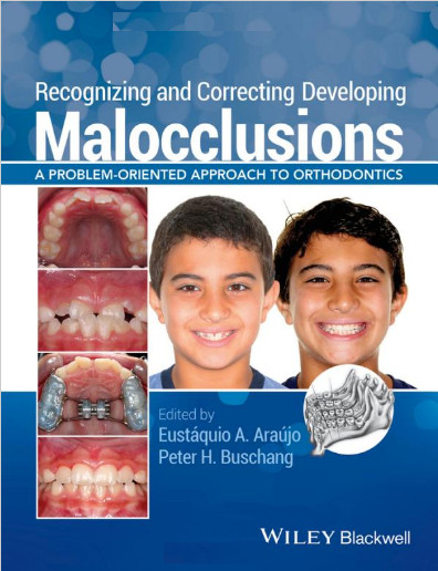 Cover of Recognizing and Correcting Developing Malocclusions: A Problem-Oriented Approach to Orthodontics 1st Edition