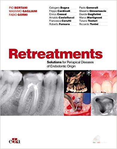 Retreatments: Solutions for Periapical Diseases of Endodontic Origin PDF