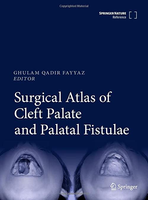 Cover of Surgical Atlas of Cleft Palate and Palatal Fistulae 1st ed. 2022 Edition PDF