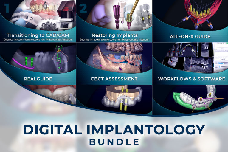 The Ultimate Digital Implantology Course Bundle