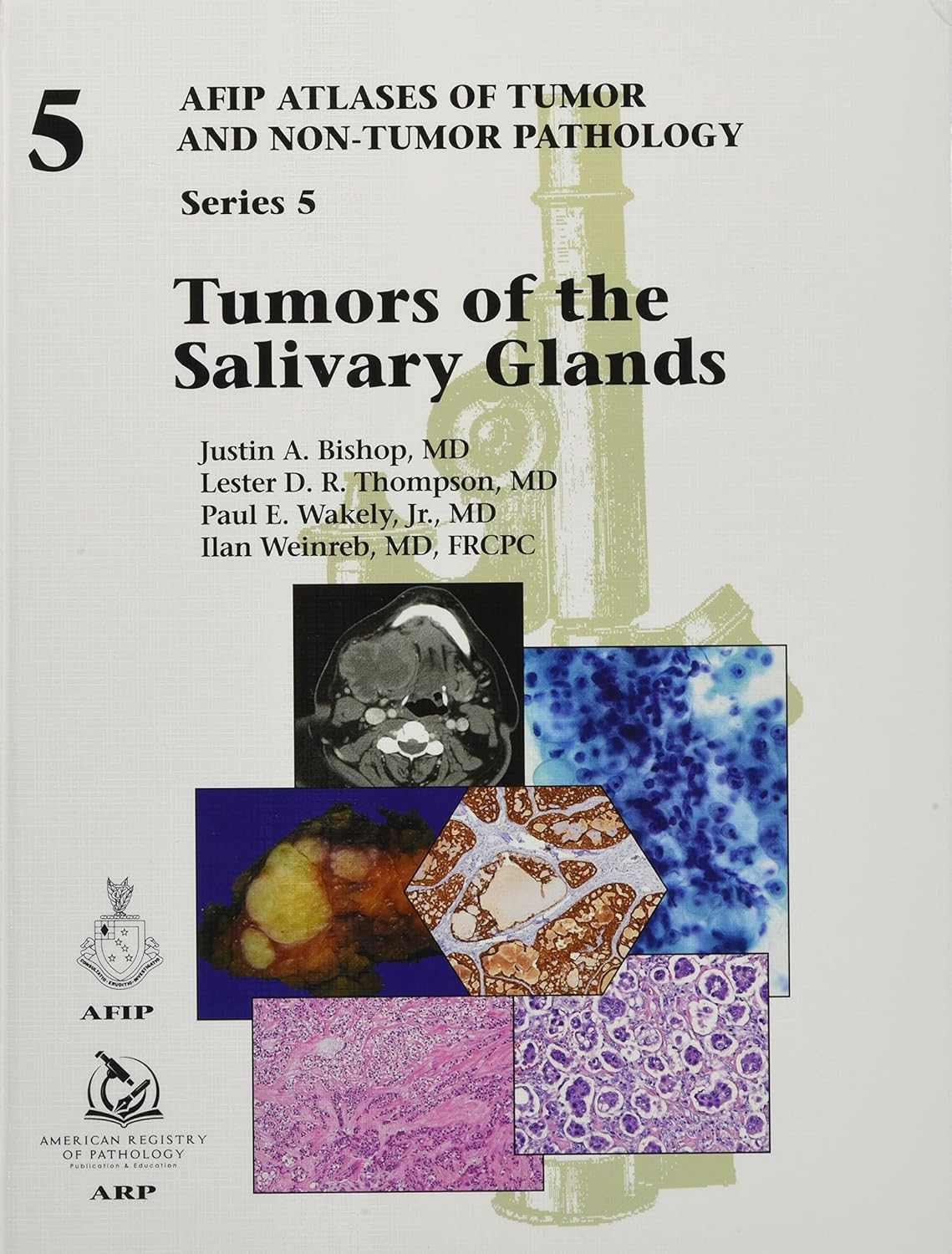 Tumors of the Salivary Glands: Series 5 (Original PDF from Publisher)