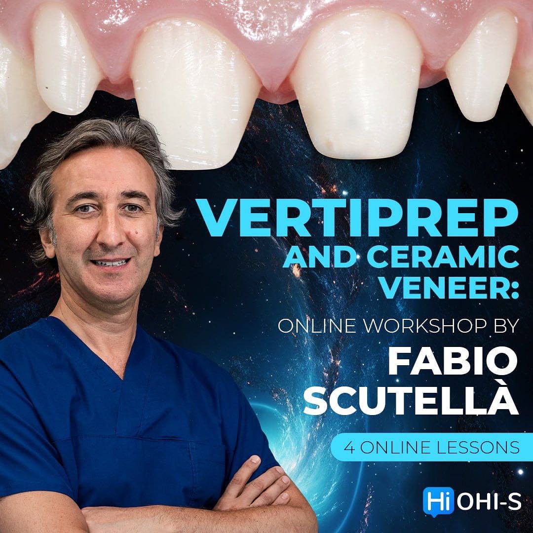 Cover of VertiPrep and Ceramic veneers: online workshop by Fabio Scutella