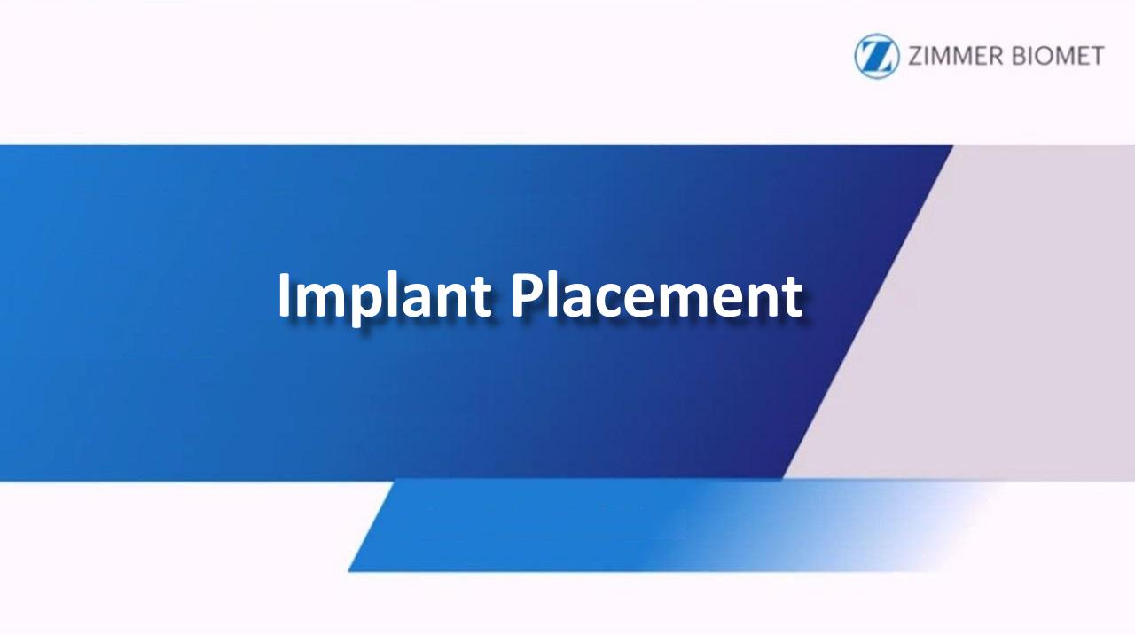 Cover of Zimmer Biomet Implant Placement